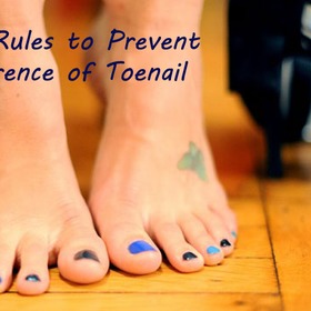 5 GREAT RULES TO PREVENT RECURRENCE OF TOENAIL FUNGUS