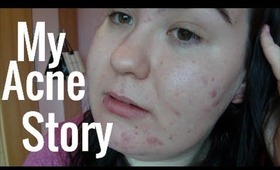 My Acne Story, Makeup Tips And Advice