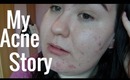 My Acne Story, Makeup Tips And Advice