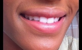 How to get Whiter Teeth FAST!