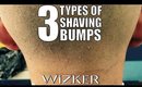 What Most People Don't Know About the 3 Types of Shaving Bumps