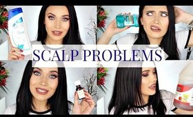 I'M FLAKEY! This Is How I Fix It: Dandruff & Other Scalp Problems!