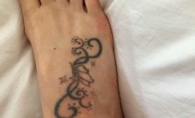 Tattoo Removal