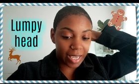 I GOT SUCH A LUMPY HEAD ...GETTING MY NAILS DONE ...COOKING ROAST Vlogmas #7 & #8