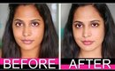 How To Lighten Skin Naturally and Instantly | ShrutiArjunAnand