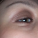 Bronze eye 