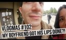 VLOGMAS #102: MY BOYFRIEND GOT HIS LIPS DONE?! | SCCASTANEDA