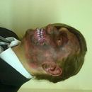 Harvey 'Two Face' Dent