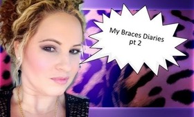 MY BRACES DIARIES # 2