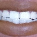 Maintain pearly white teeth 😉