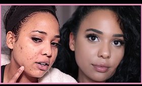 My Everyday Full Coverage 10 Minute Makeup Routine | How I Cover Acne Scars | Ashley Bond Beauty