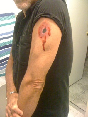 Bullet Wound 2
