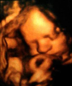 17.O3.12' 4D scan of my son at 31 weeks 5 days ♥