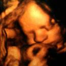 4D scan of my son at 31 weeks 5 days ♥