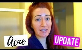 HOW'S MY SKIN?! ACNE UPDATE! | JESS BUNTY VLOG #2