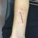 Cut and stitches 