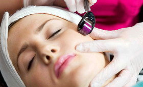 Dermal Needling: What It Is and Who It’s For