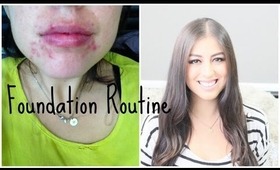 Acne Foundation Routine (Best Full Coverage Routine)