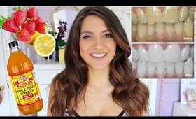 How to WHITEN YOUR TEETH | DIY Teeth Whitening FAST + CHEAP!