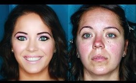 Full Coverage Color Correction for ROSACEA Tips & Tricks for Fall & Winter | mathias4makeup