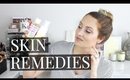 Skin Remedies for Babies: Acne, Cradle Cap, Dryness | Kendra Atkins