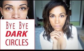 Bye, Bye! Dark Circles