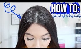 How To Get Rid Of  A DRY Scalp & Dandruff !!