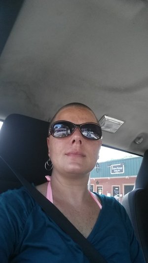 My shaved head.