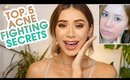 TOP 5 ACNE FIGHTING INGREDIENTS I CANT LIVE WITHOUT!