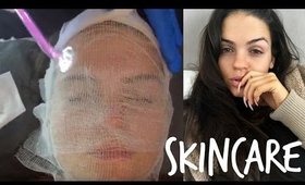 SKINCARE for ACNE, ACNE SCARS, LARGE PORES, & BLACKHEADS | LIVE