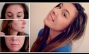 Flawless Acne Coverage Foundation Routine [Spring 2014]