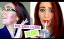 MAKING YOUTUBE VIDEOS, GOING BACK TO SCHOOL & ACNE WOES! | Jess Bunty Vlog #4