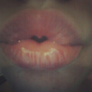 Lips