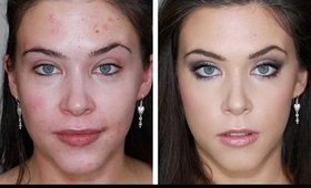 ACNE FOUNDAION ROUTINE FOR FLAWLESS SKIN (FULL COVERAGE TUTORIAL) BLEMISHES, ACNE, SCARING