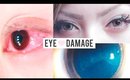 WTF Circle Lens Eye Damage: My Story