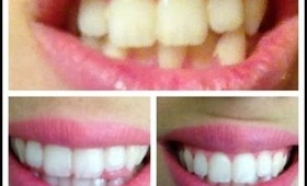 White Sparkling Teeth How to and Demo