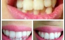 White Sparkling Teeth How to and Demo