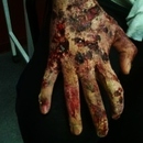 Zombie Hand