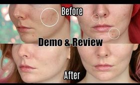 Trophy Skin MicrodermMD REVIEW & DEMO | Before and After