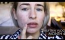 Roaccutane Daily Skin Vlog - Month 4