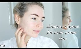 SKINCARE REGIME FOR ACNE PRONE SKIN!