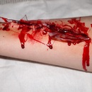 Wounded arm 