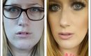Lip Injections - My Experience