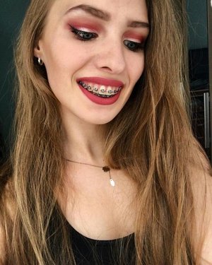 After much trial and error, I've finally found a makeup design that compliments my braces nicely; not drawing undue attention to them. Do you agree?