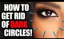 How to Get Rid of Dark Circles!