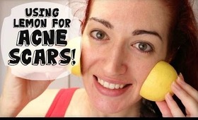 UPDATED! FADE ACNE SCARS WITH LEMON! Naturally Lighten Skin At Home!