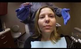 Getting Invisalign Molds