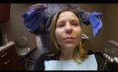 Getting Invisalign Molds