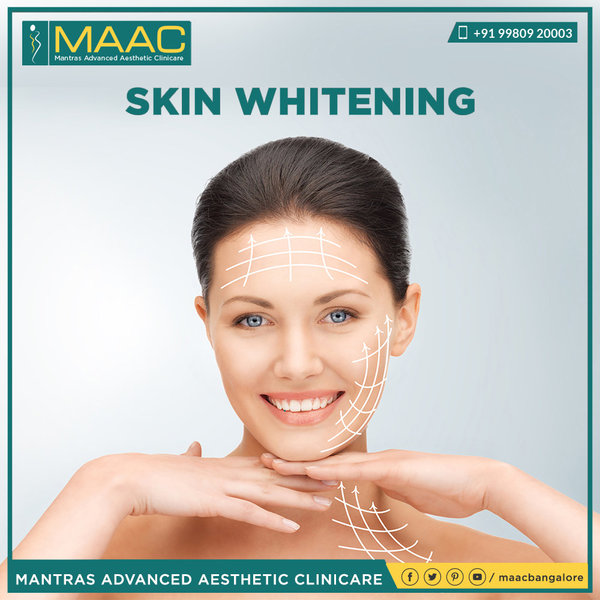 Skin whitening Treatment in Bangalore Maac B.'s Photo Beautylish