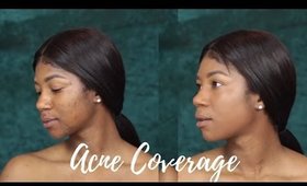 Acne Full Coverage Foundation Routine | No Color Correcting | WOC